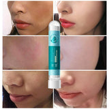 Hyaluronic Acid Face Mask